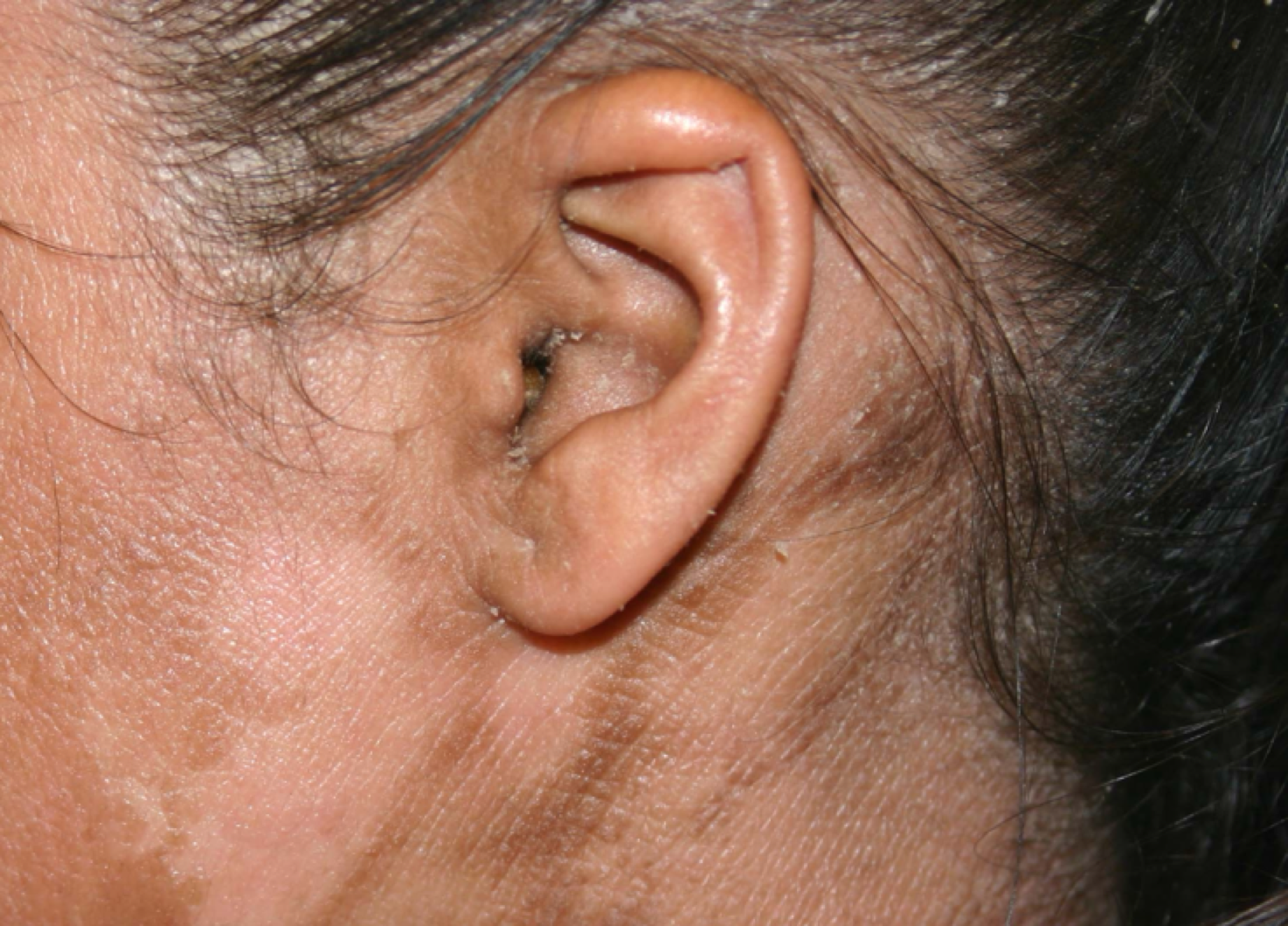 Ear Care for Adults