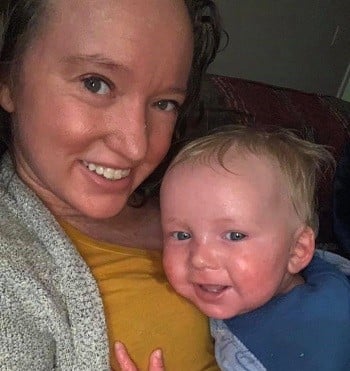Inherited Courage: Living and Thriving with Ichthyosis with Confetti